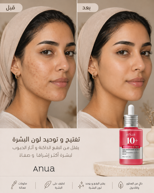 Anua Niacinamide 10% + TXA 4% | سيروم أنوا الأحمر للتصبغات