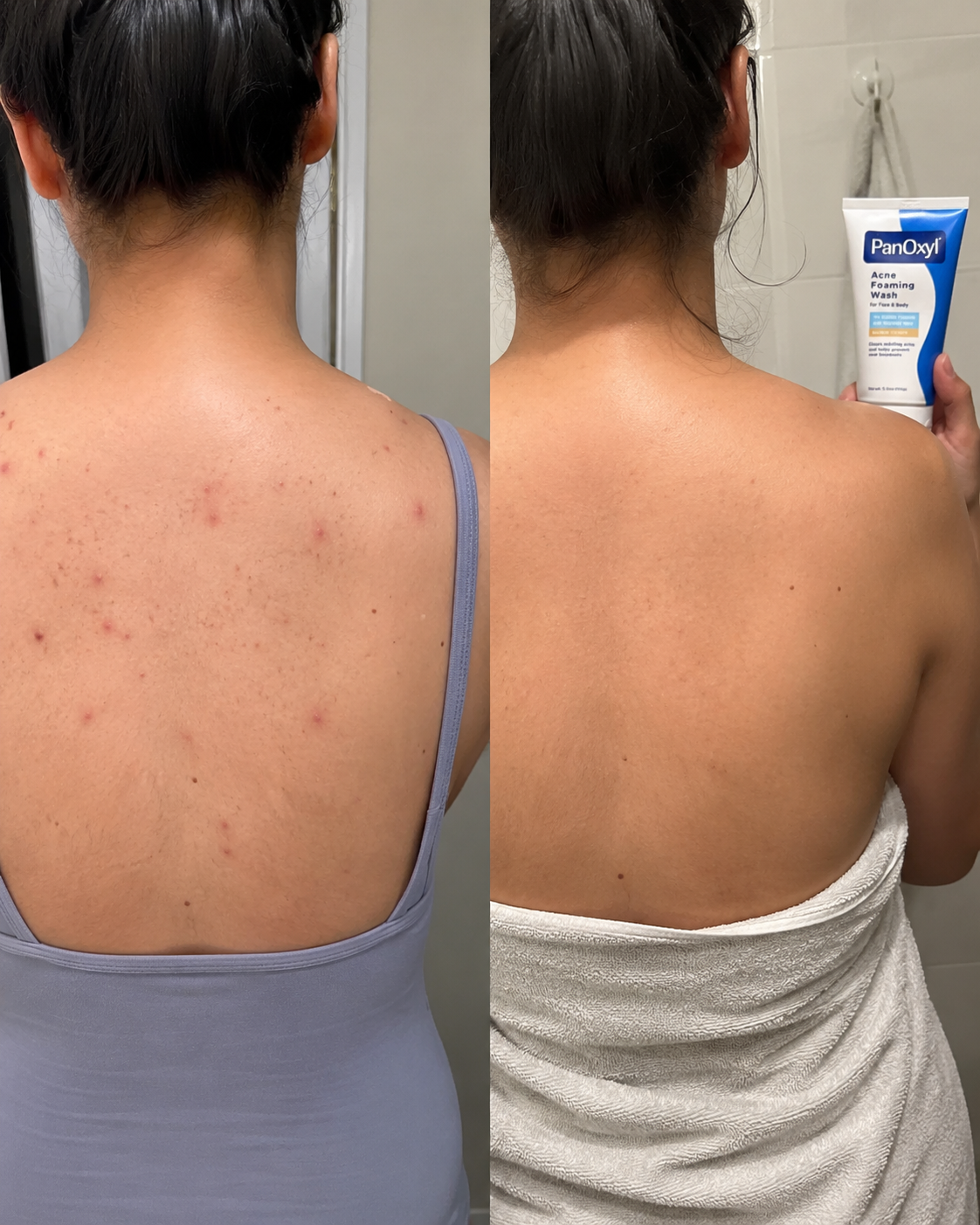 PanOxyl Acne Wash | غسول بانوكسيل للحبوب